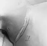 T107 propellerskador