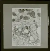 2782/6 LKB Microskopbilder av cellprover från kundens original. Svart/vit neg. för färgseparation