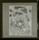 2782/6 LKB Microskopbilder av cellprover från kundens original. Svart/vit neg. för färgseparation