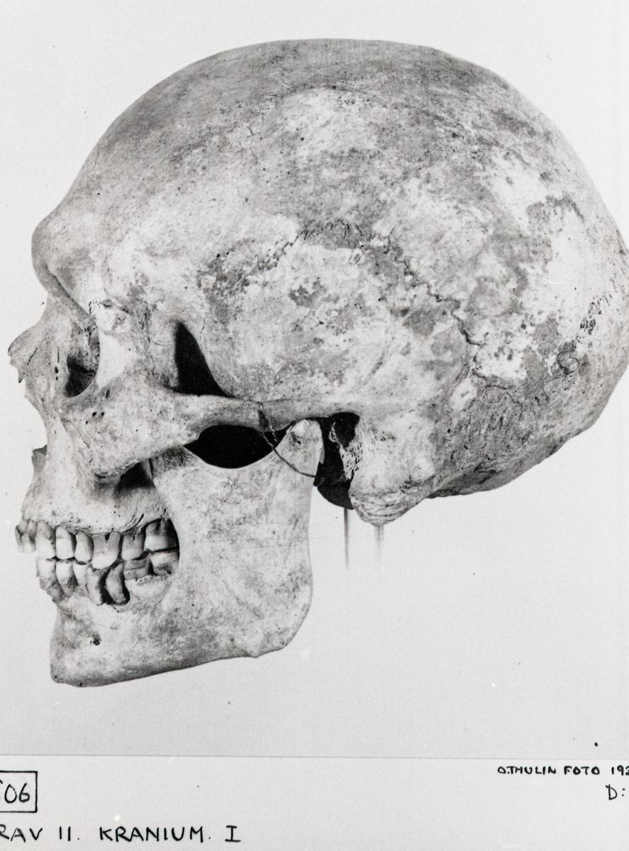 O. Thulin, Group 11. Cranium 1. From the side.