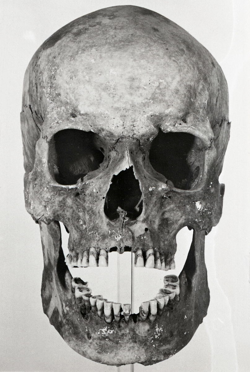 O. Thulin, Group 31. Skeleton II. Cranium from the front.