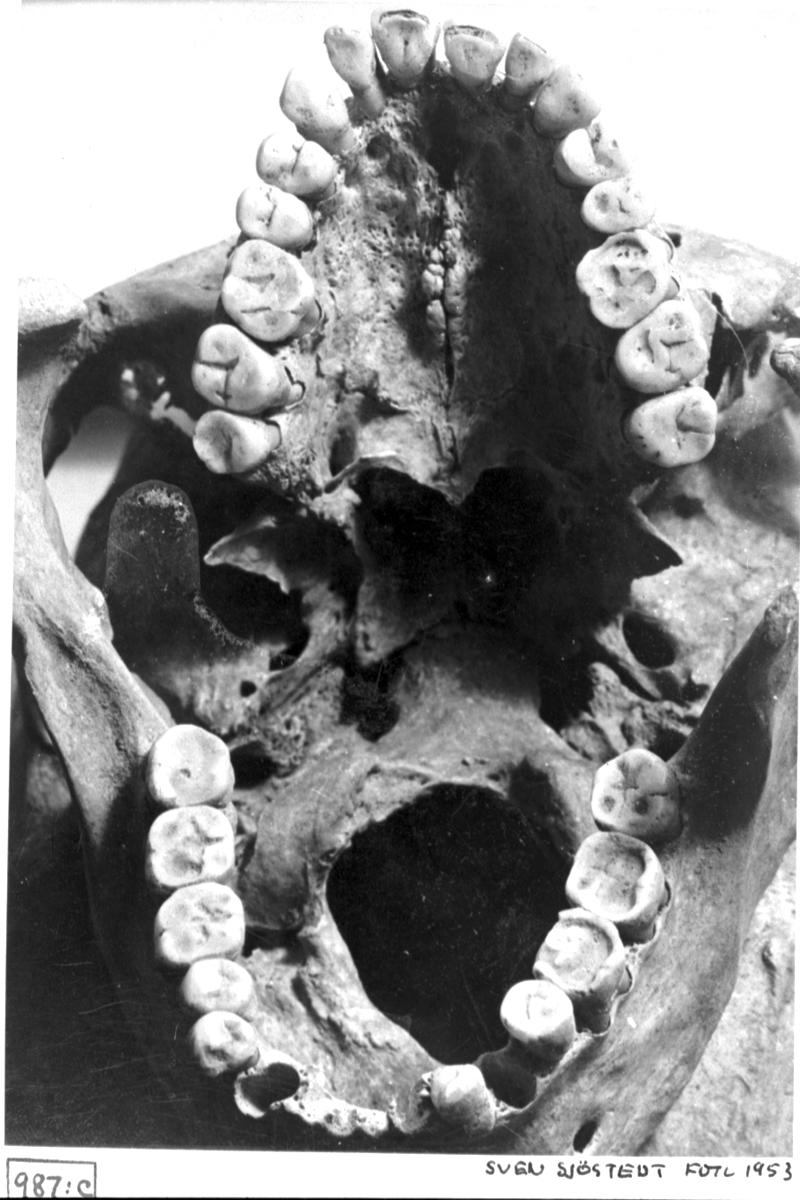 Sven Sjöstedt, Group 33. Kranium, the teeth in the jaw.