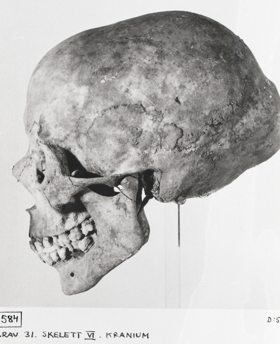 O. Thulin, Group 31. Skeleton 6. The cranium from the side.